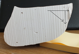 Fig 4. Horizontal line Talo/nav drift and vertical line Talo/nav drop. Diagonal line is the resultant angular movement which must be opposed by the orthotic device.